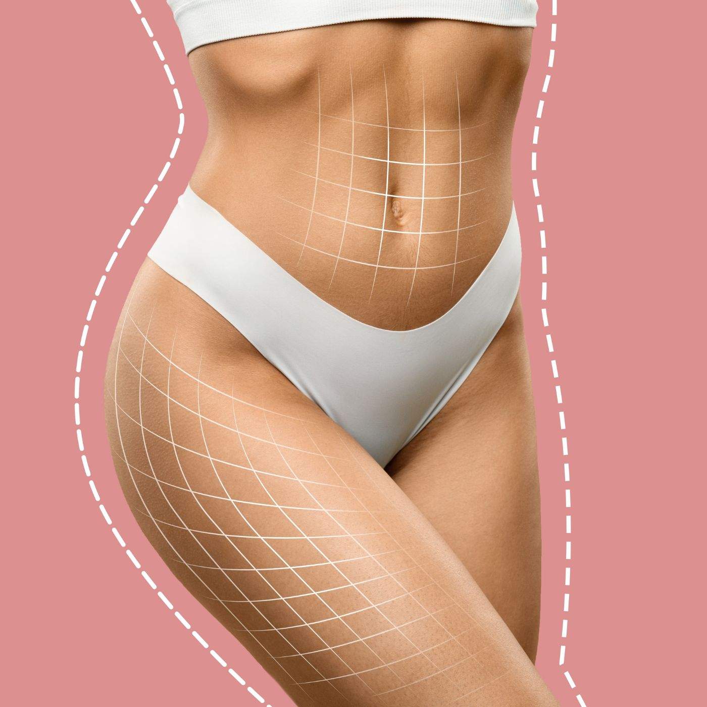 graphic of areas liposuction can target on top of a woman's midsection